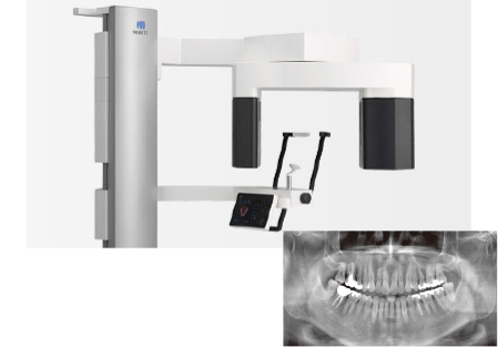 より正確な画像診断ができる歯科用CT