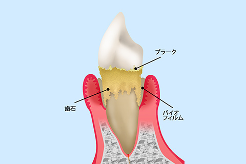 当院の治療法について