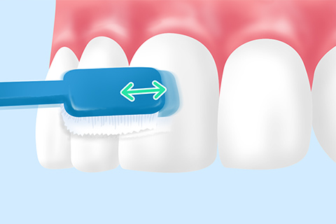 ブラッシング指導で効果的なホームケアを